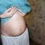 5. Растяжки при беременности фото