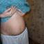 4. Растяжки во время беременности фото