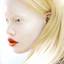 14. Альбинизм фото