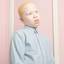 18. Альбинизм фото
