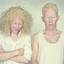 26. Альбинизм фото